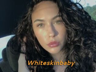 Whiteskinbaby